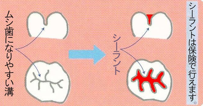 小児3画像